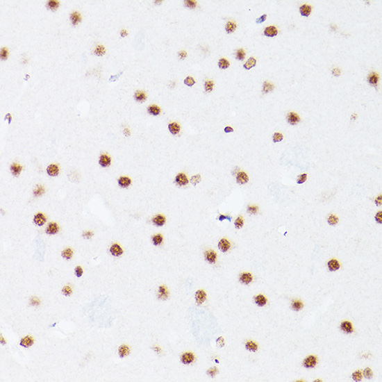 NSUN5 Rabbit polyclonal antibody