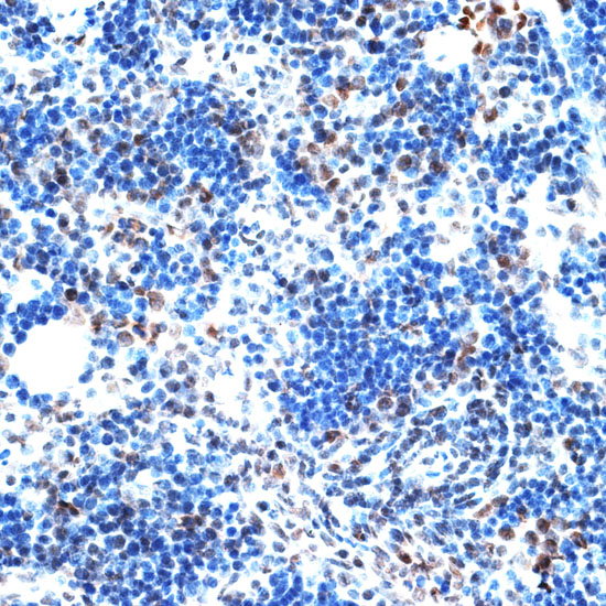 AQR Rabbit polyclonal antibody