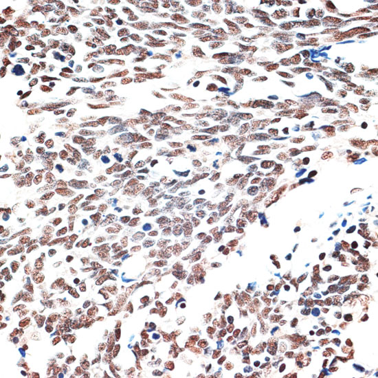 AQR Rabbit polyclonal antibody