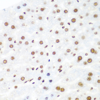 Argonaute-2 Rabbit polyclonal antibody