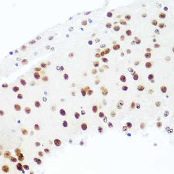Argonaute-2 Rabbit polyclonal antibody