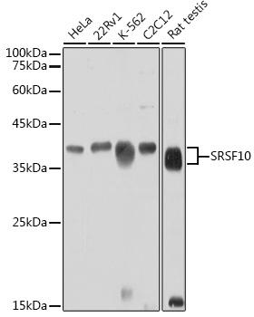 SRSF10 Rabbit polyclonal antibody