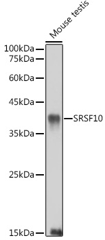 SRSF10 Rabbit polyclonal antibody