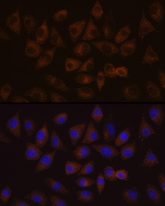 HDLBP Rabbit polyclonal antibody