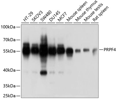 PRPF4 Rabbit polyclonal antibody