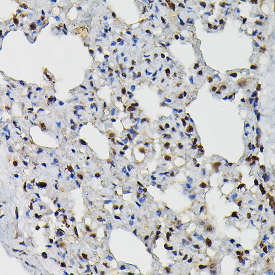 PRPF4 Rabbit polyclonal antibody