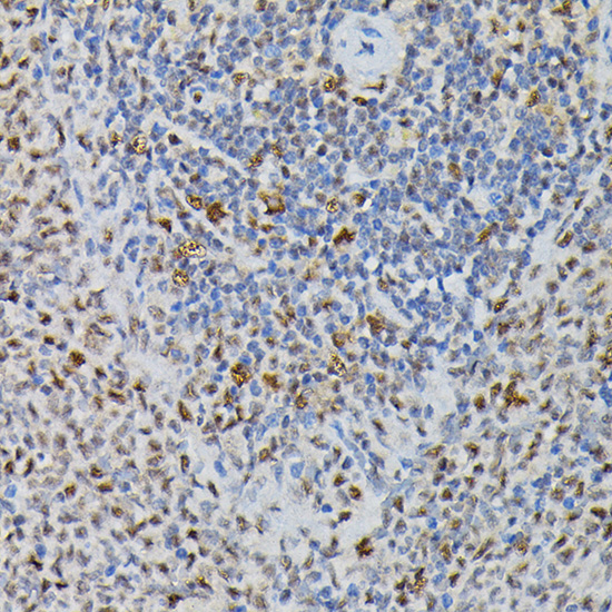 PRPF4 Rabbit polyclonal antibody