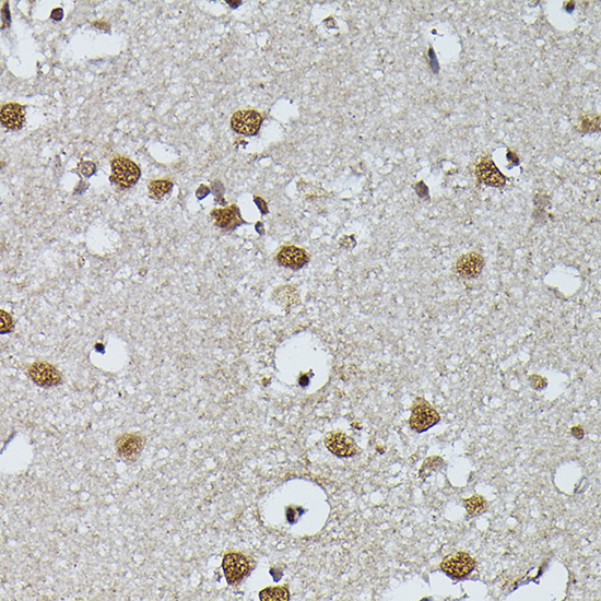 PRPF4 Rabbit polyclonal antibody