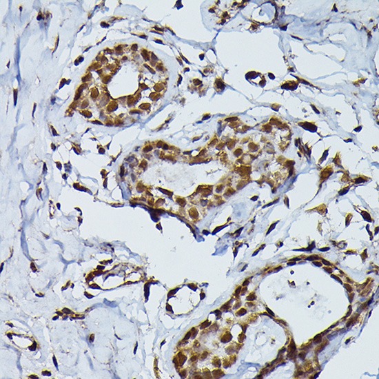 PRPF4 Rabbit polyclonal antibody