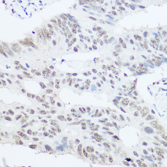 PRPF8 Rabbit polyclonal antibody