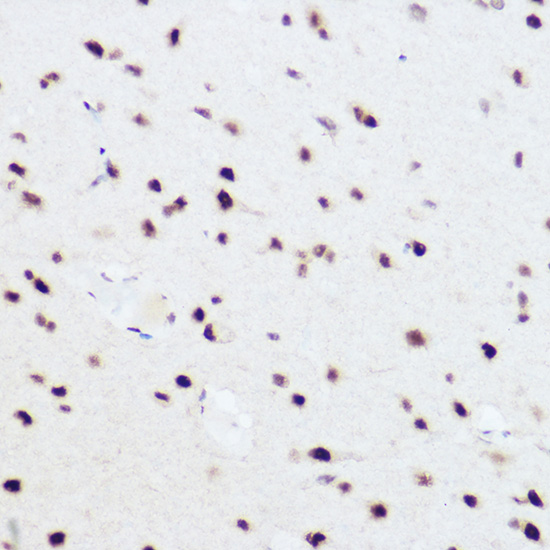 PRPF8 Rabbit polyclonal antibody