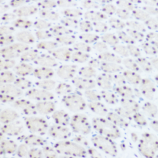 PRPF8 Rabbit polyclonal antibody
