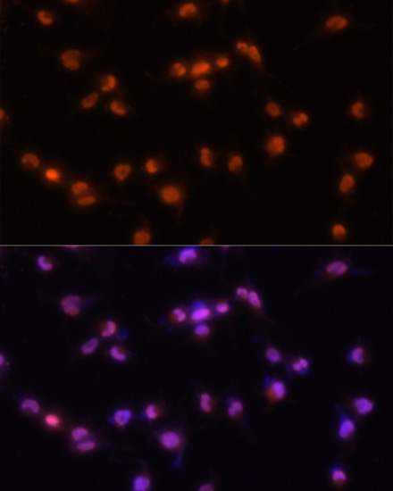 PRPF8 Rabbit polyclonal antibody