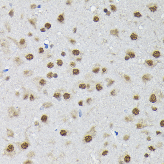 PTBP2 Rabbit polyclonal antibody