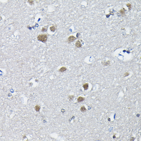 PTBP2 Rabbit polyclonal antibody
