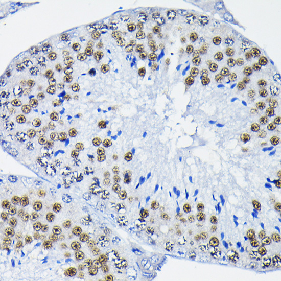 PTBP2 Rabbit polyclonal antibody
