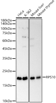 RPS10 Rabbit polyclonal antibody