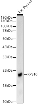 RPS10 Rabbit polyclonal antibody