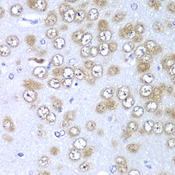 RPS10 Rabbit polyclonal antibody