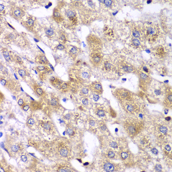 RPS10 Rabbit polyclonal antibody