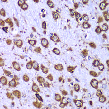 RPS10 Rabbit polyclonal antibody