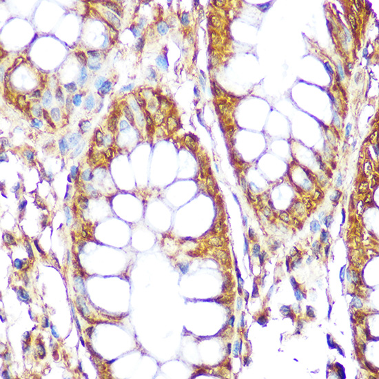 S6 Ribosomal Protein (RPS6) Rabbit polyclonal antibody