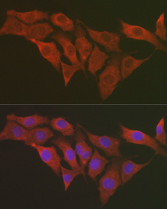 S6 Ribosomal Protein (RPS6) Rabbit polyclonal antibody