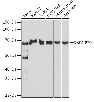 SNRNP70 Rabbit polyclonal antibody
