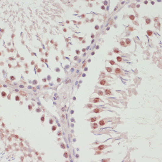 SNRNP70 Rabbit polyclonal antibody
