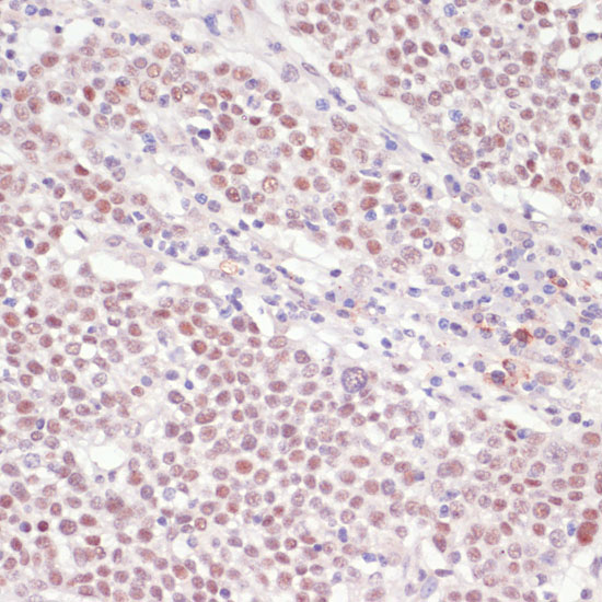 SNRNP70 Rabbit polyclonal antibody
