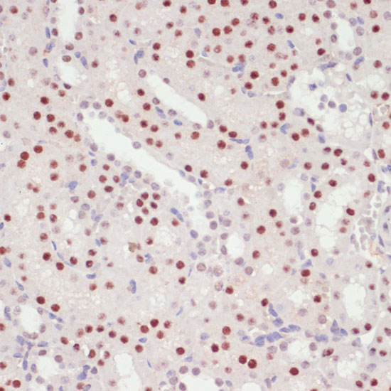 SNRNP70 Rabbit polyclonal antibody