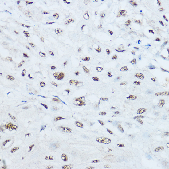SRRM1 Rabbit polyclonal antibody