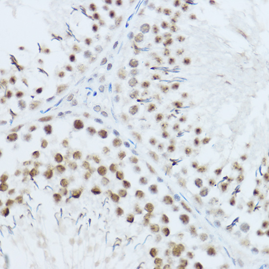 SRRM1 Rabbit polyclonal antibody