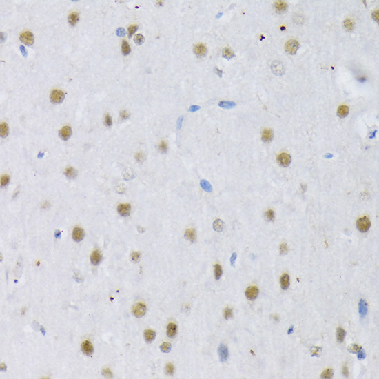 SRSF3 Rabbit polyclonal antibody