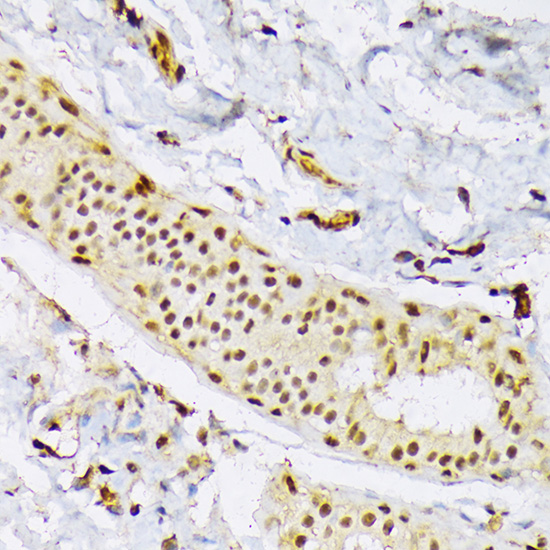 SRSF3 Rabbit polyclonal antibody