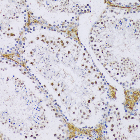 SRSF3 Rabbit polyclonal antibody