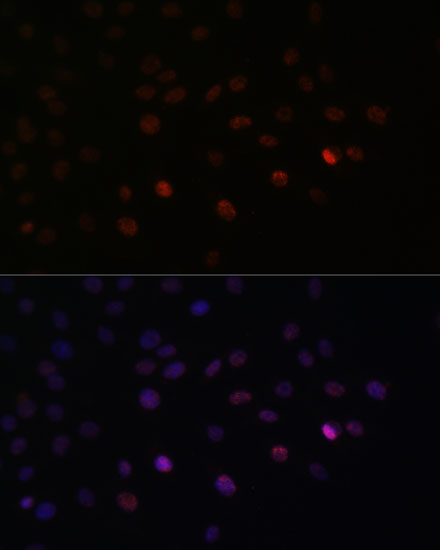 SRSF3 Rabbit polyclonal antibody