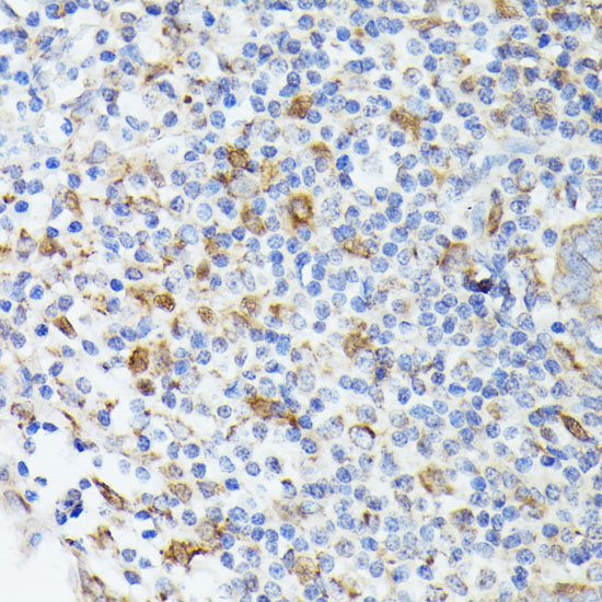TIAL1 Rabbit polyclonal antibody