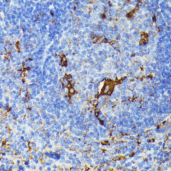 TIAL1 Rabbit polyclonal antibody