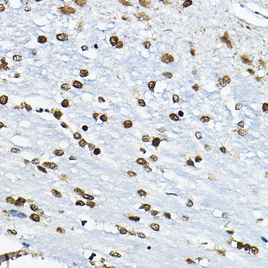 CIRBP Rabbit polyclonal antibody