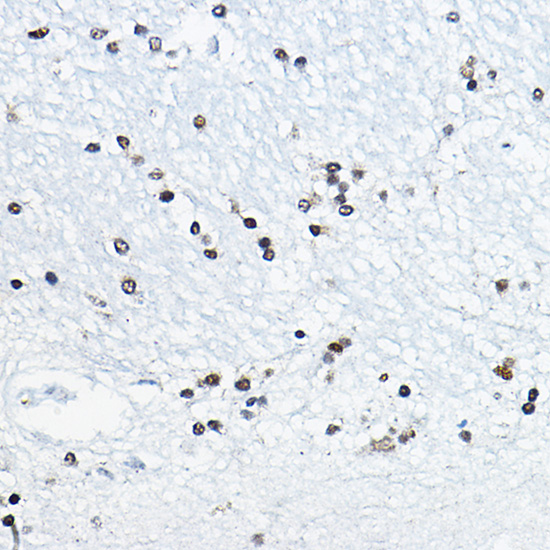 CIRBP Rabbit polyclonal antibody