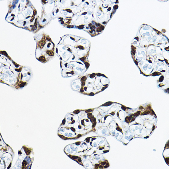 CIRBP Rabbit polyclonal antibody