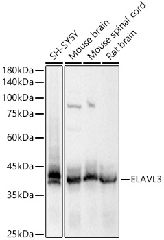 ELAVL3 Rabbit polyclonal antibody