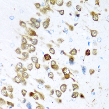 ELAVL3 Rabbit polyclonal antibody