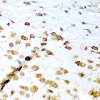ELAVL3 Rabbit polyclonal antibody