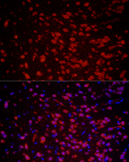 ELAVL3 Rabbit polyclonal antibody