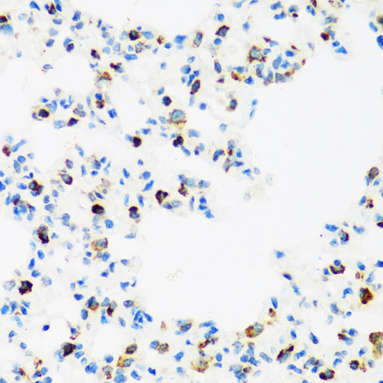 FMRP Rabbit polyclonal antibody