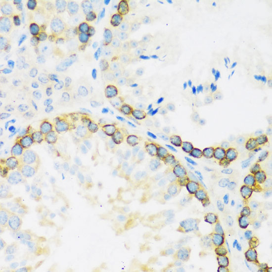 FMRP Rabbit polyclonal antibody