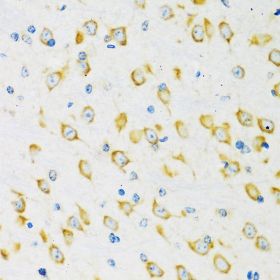 FMRP Rabbit polyclonal antibody