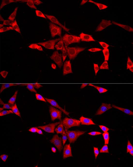FMRP Rabbit polyclonal antibody